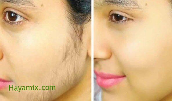 وصفات طبيعية لإزالة شعر الوجه الزائد من غير ألم