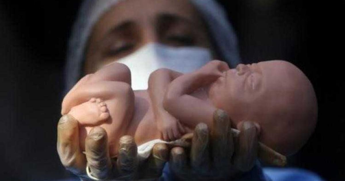 تفاصيل: السعودية: قرار بفرض عقوبات على طبيب نفذ عملية إجهاض غير قانونية