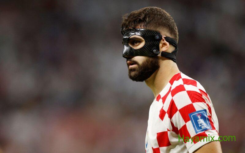 لماذا يرتدي لاعب كرواتيا قناع أسود على وجهه